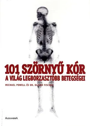 101 szörnyű kór Legnépszerűbb
