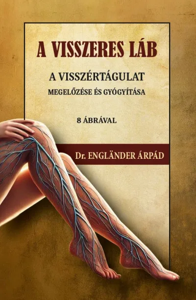 A visszeres láb a visszértágulat megelőzése és gyógyítása Akció
