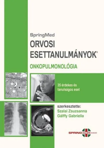 Orvosi Esettanulmányok - Onkopulmonológia - 35 érdekes és tanulságos eset Újdonság