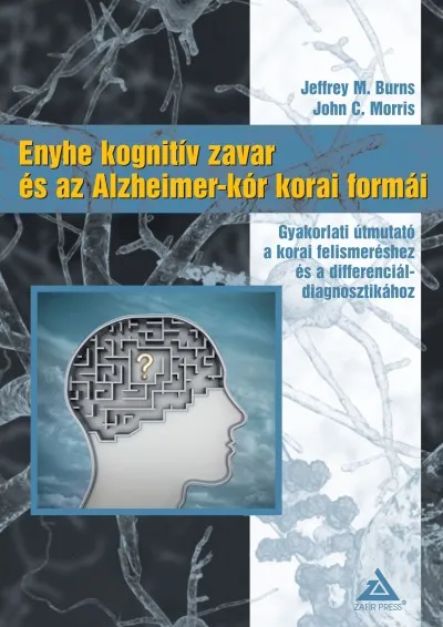 Kedvezmény Enyhe kognitív zavar és az Alzheimer-kór korai formái - Gyakorlati útmutató a korai felismeréshez és a differenciáldiagnosztikához
