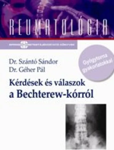 Biztonságos vásárlás Kérdések és válaszok a Bechterew-kórról