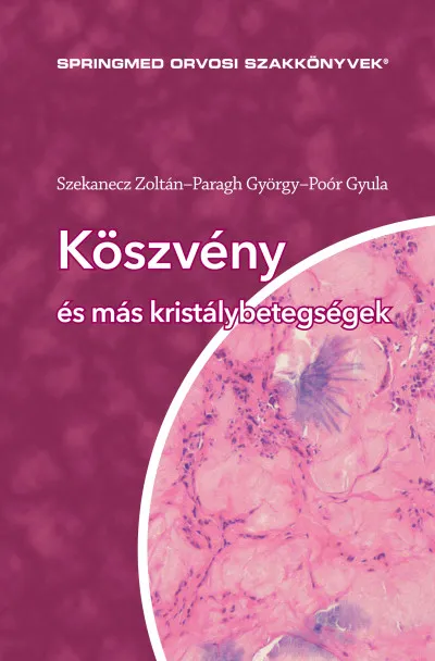 Köszvény és más kristálybetegségek Ajánlat