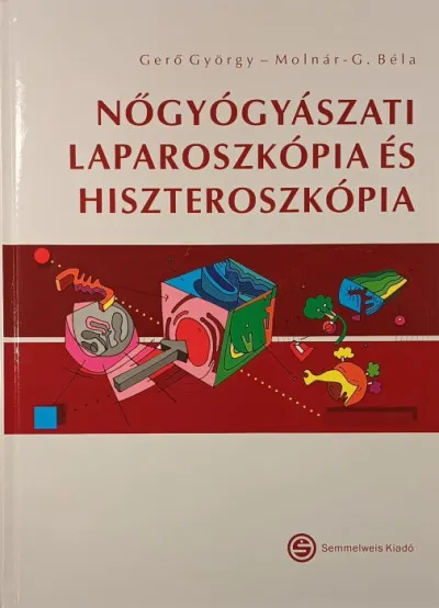 Legnépszerűbb Nőgyógyászati laparoszkópia és hiszteroszkópia