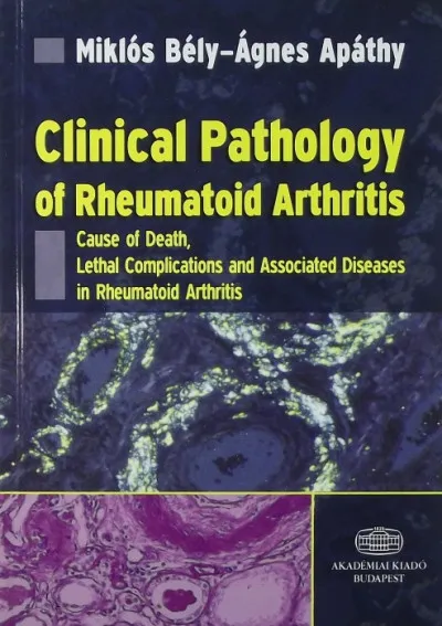 Legjobb ár Clinical Pathology of Rheumatoid Arthritis - Cause of Death, Lethal Complications and Associated Diseases in Rheumatoid Arthritis