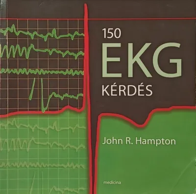 150 EKG kérdés Legkelendőbb