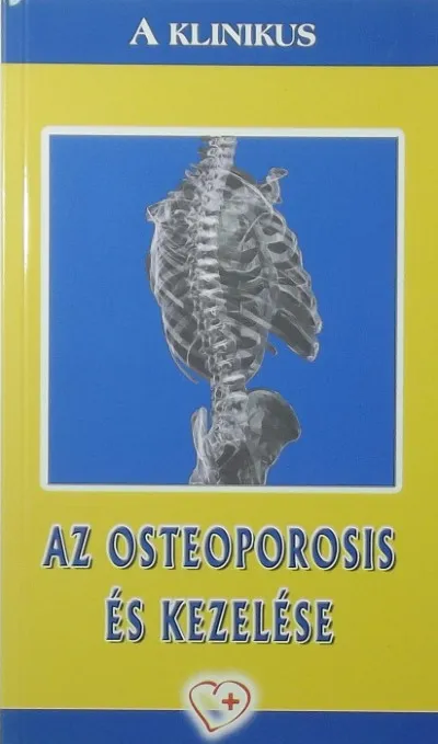 Legkelendőbb Az osteoporosis és kezelése