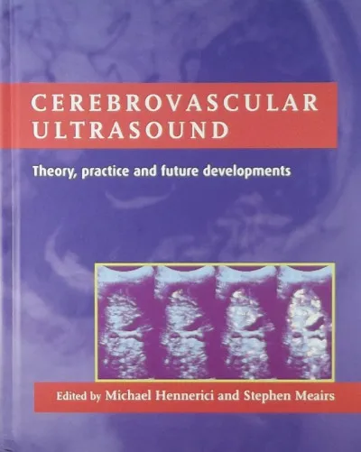 Cerebrovascular ultrasound - Theory, practice and future developments Vedd meg online