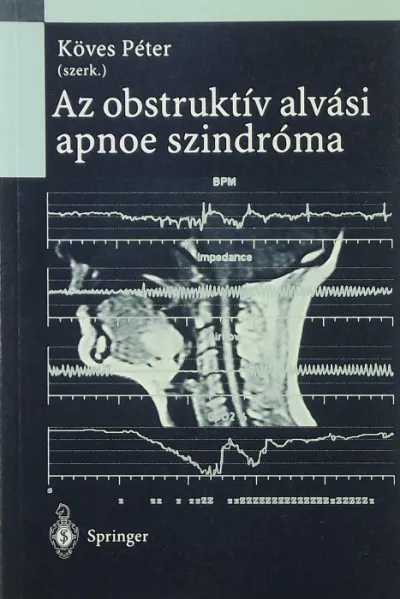 Az obstruktív alvási apnoe szindróma Szuper ajánlat
