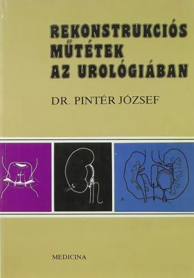 Rekonstrukciós műtétek az urulógiában Akció